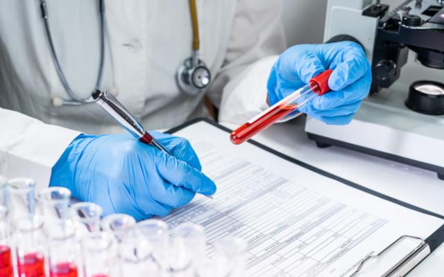 analizando la transferina