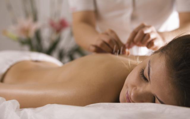 Mujer en sesión de acupuntura para dejar de fumar