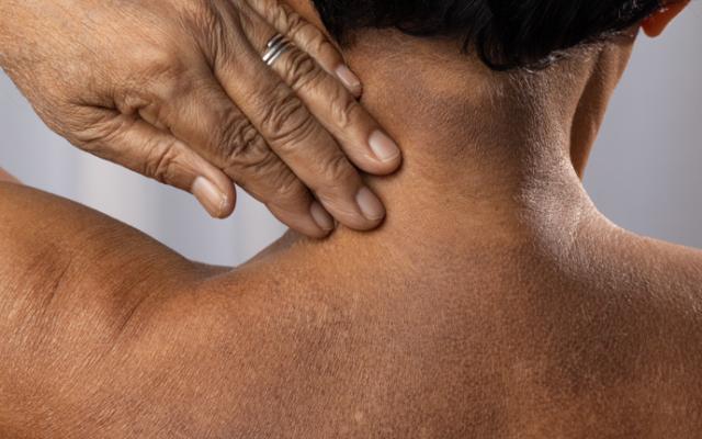 mujer con manchas blancas en la piel