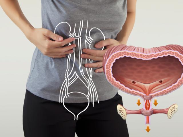 incontinencia urinaria por estrés