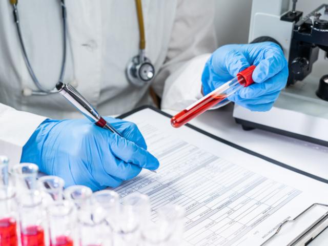 analizando la transferina