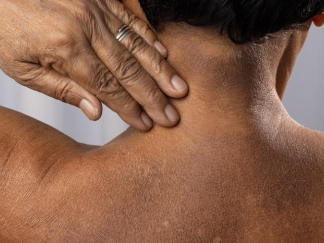 mujer con manchas blancas en la piel